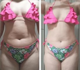 antes_e_depois_01-black-atualizada